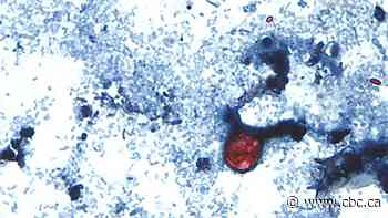 As cyclospora illnesses in U.S. surge to new record, Michigan officials eye lettuce as possible cause