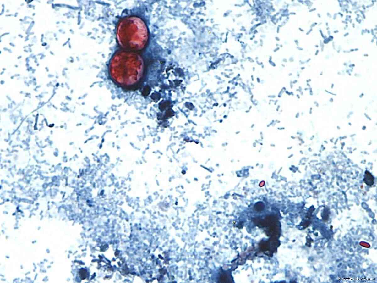 ‘Explosive diarrhea’ parasite reported in N. Va., but it’s not an outbreak, authorities say