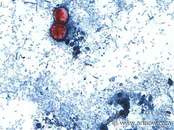 ‘Explosive diarrhea’ parasite reported in N. Va., but it’s not an outbreak, authorities say
