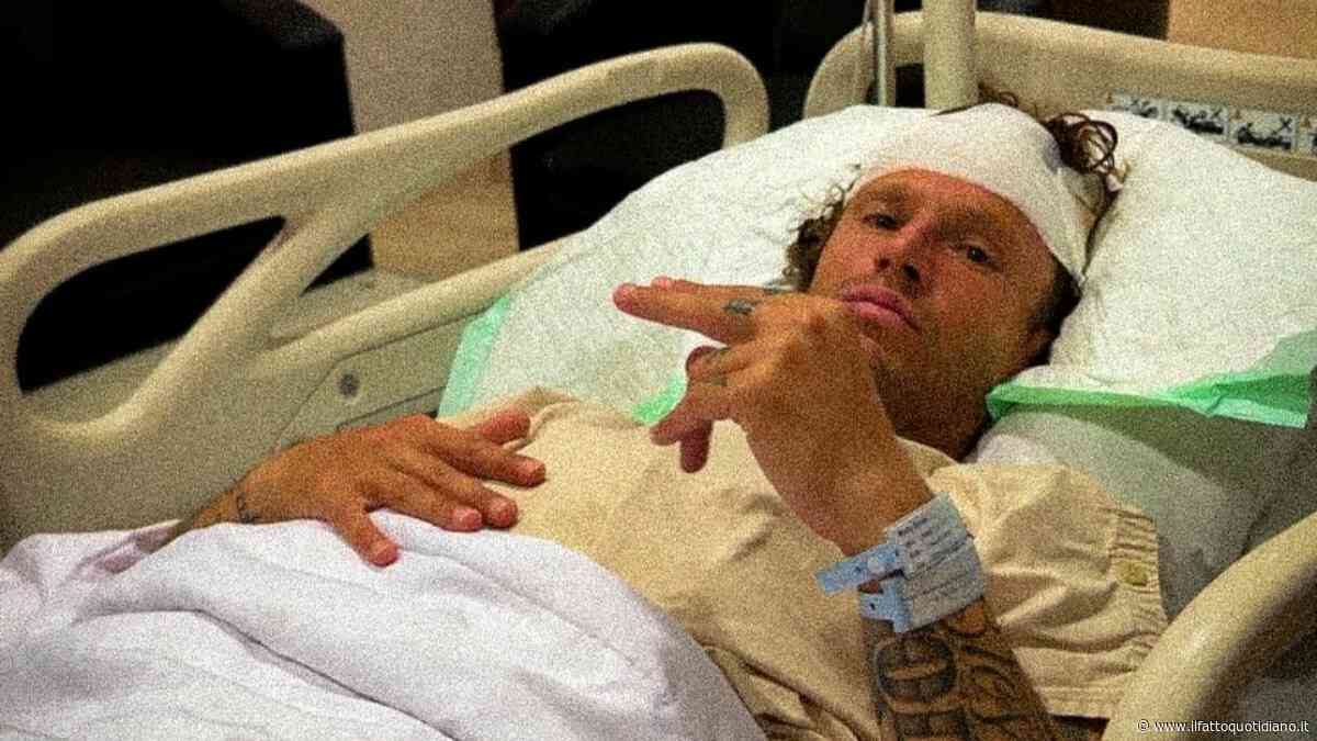 “Alcune ferite erano così profonde che si vedeva il cranio e c’erano ancora piccoli pezzi di barriera corallina incastrati all’interno”: il racconto choc del surfista Rudy Ghiara