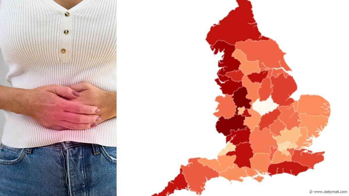 The UK's bowel cancer hotspot map: Regions hit the hardest by the explosion in the lethal disease...what's the risk in YOUR area?