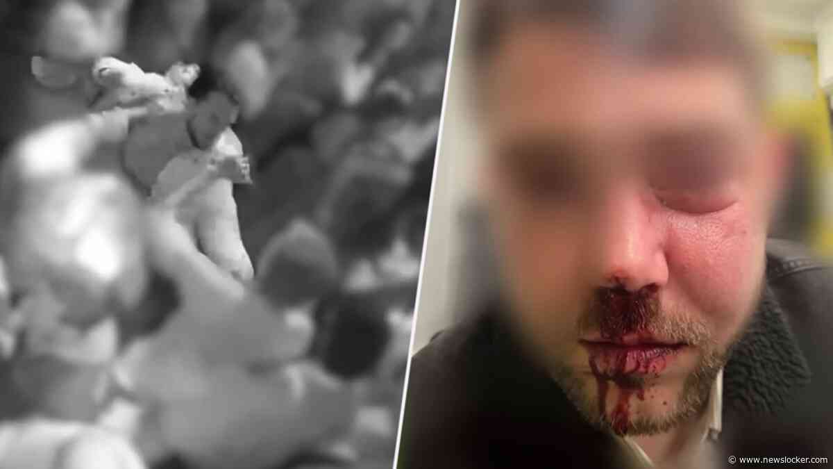 Man slaat cafébezoeker bewusteloos in Tilburg