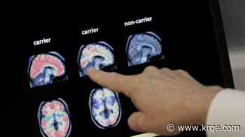 Blood test could help identify people at high risk for Alzheimer's disease, study shows