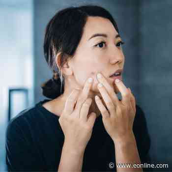 Derm Says Stop Making This Skincare Mistake, It’ll Lead to Summer Acne