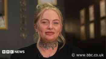 'Her ear was shattered' - home piercings leading to deformities, says expert