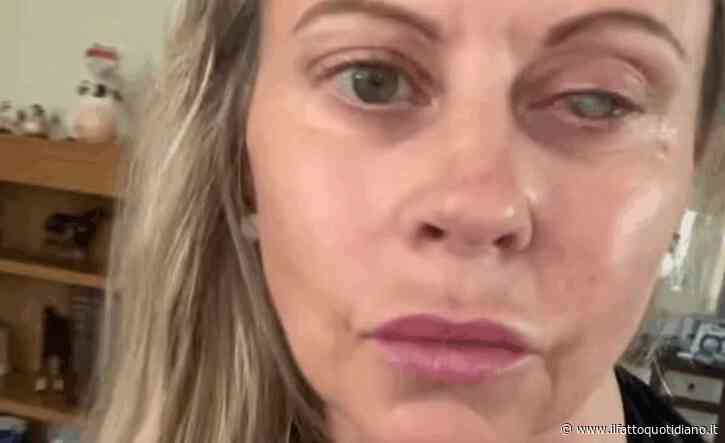 “Un parassita ha divorato il mio occhio, la cornea e tutti i miei nervi. E’ stato un dolore lancinante. I medici non riuscivano a credere alla velocità con cui ha agito”: la storia di Emma Marsden