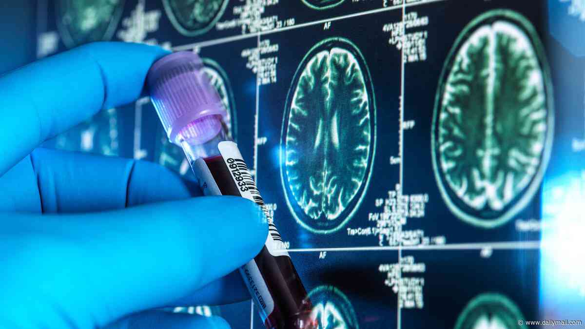 Alzheimer's 'wonder drug' could delay disease for three years - 90% of brain damage vanished in new trial