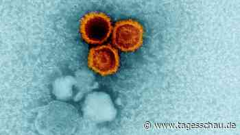 Studie: Wie ein Virus Multiple Sklerose mitauslösen kann