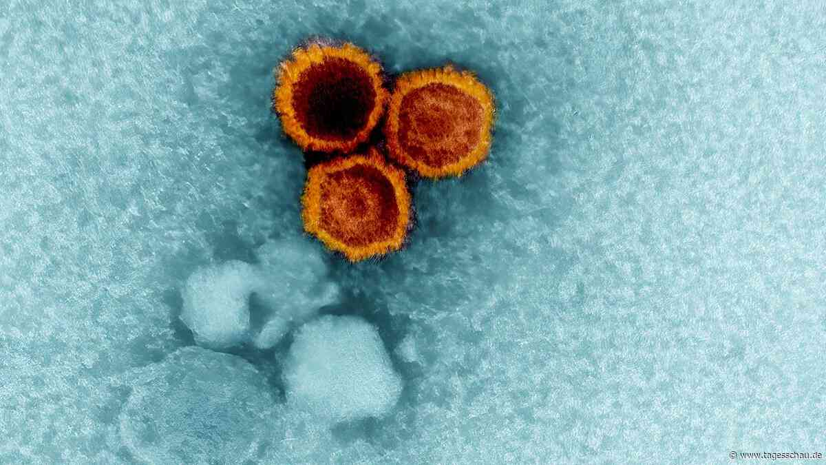 Studie: Wie ein Virus Multiple Sklerose mitauslösen kann