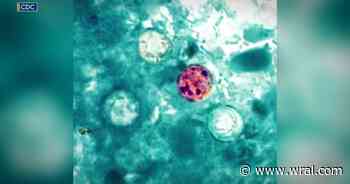 More people are seeking Cyclospora tests. Here's what patients should know