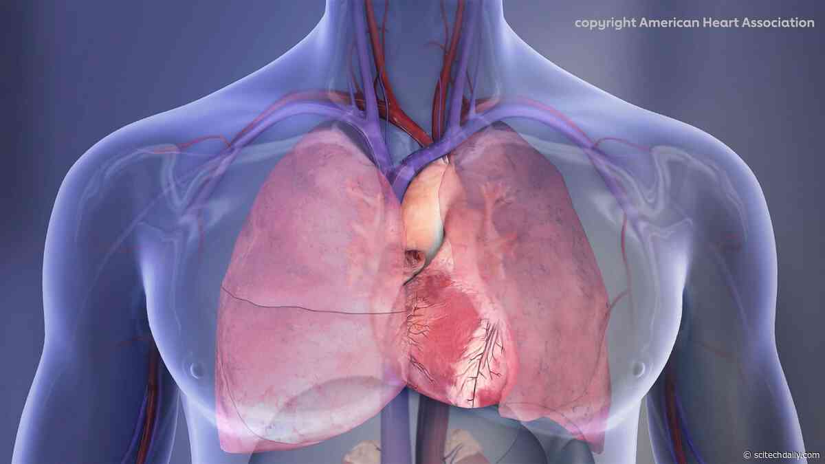 Common Mouth Bacteria May Trigger Dangerous Calcium Buildup in the Heart