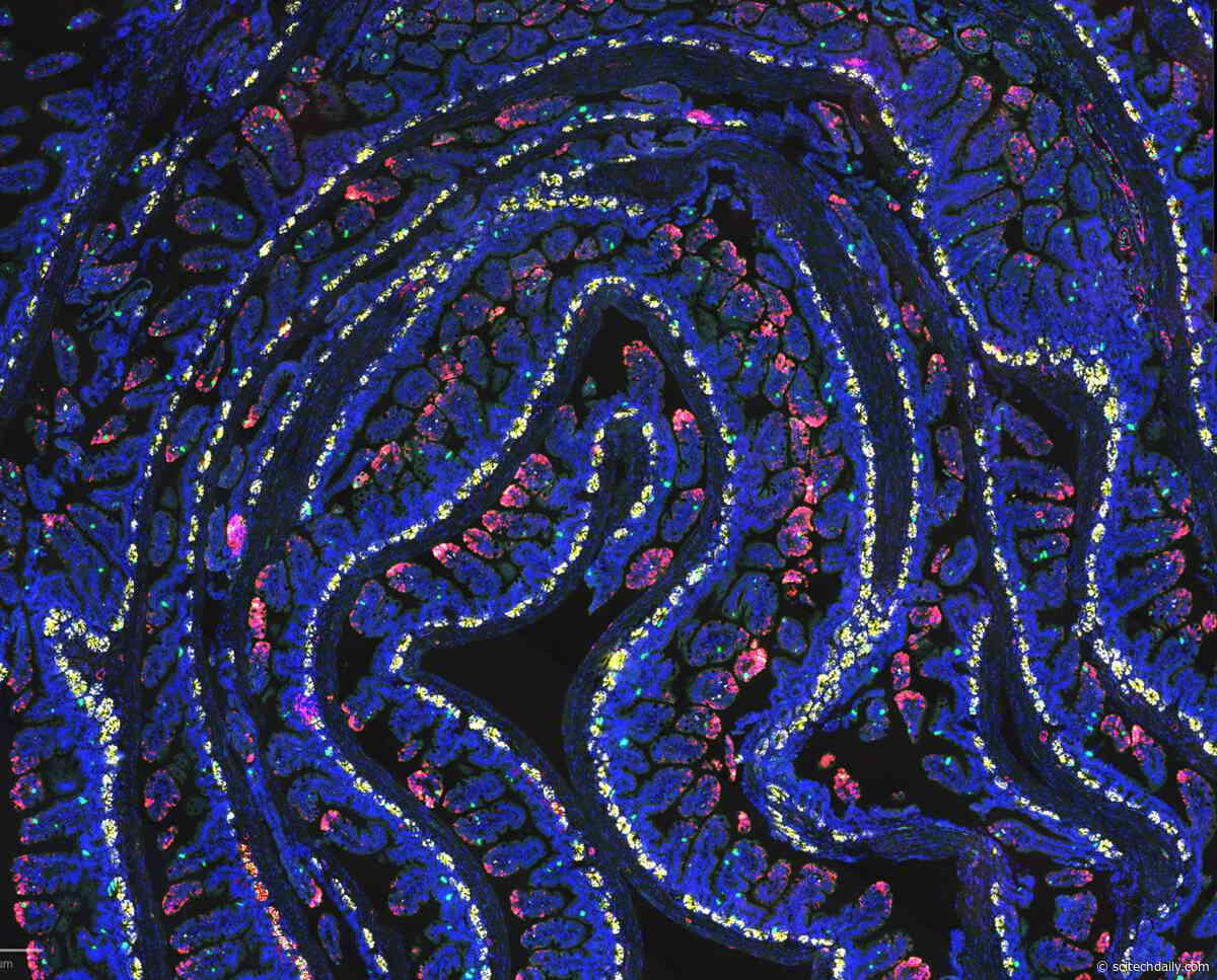A 24-Hour Fast Activates a Microbial Pathway That Helps Heal the Gut