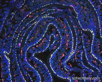 A 24-Hour Fast Activates a Microbial Pathway That Helps Heal the Gut