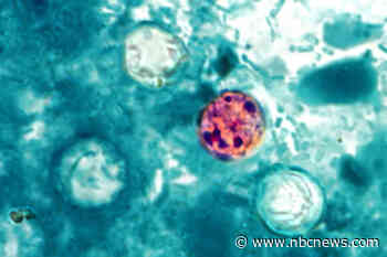 Nearly 7,000 cases of cyclosporiasis confirmed or under investigation nationwide, CDC says