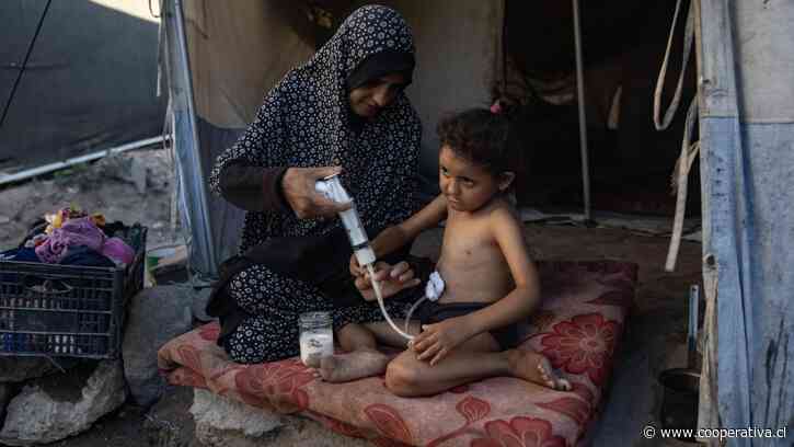Alerta por brote de varicela en Gaza: Registró 9.300 casos en solo dos semanas