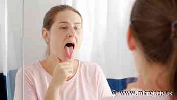 NHS says 'call 999' now if you spot this sign on your tongue