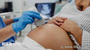 Trust changes baby growth monitoring after feedback