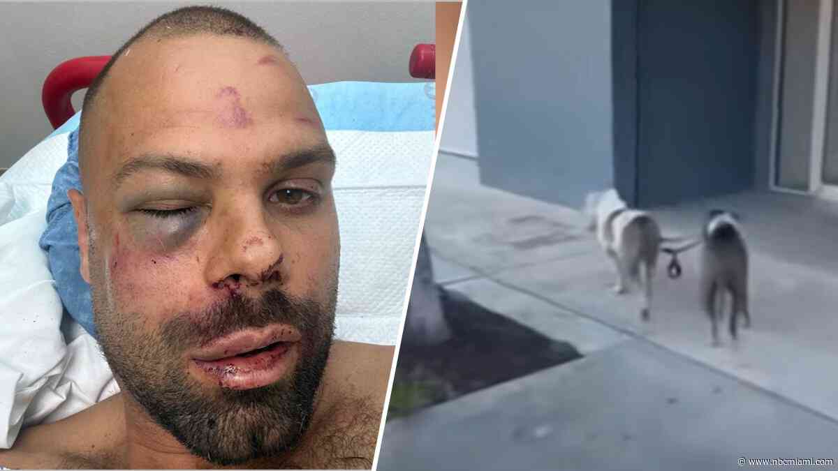 Man arrested after victim says he ordered pit bulls to attack him in Wynwood