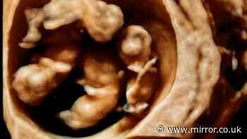 Mum's 'immense surprise' as she gives birth to 'unheard of' identical quadruplets