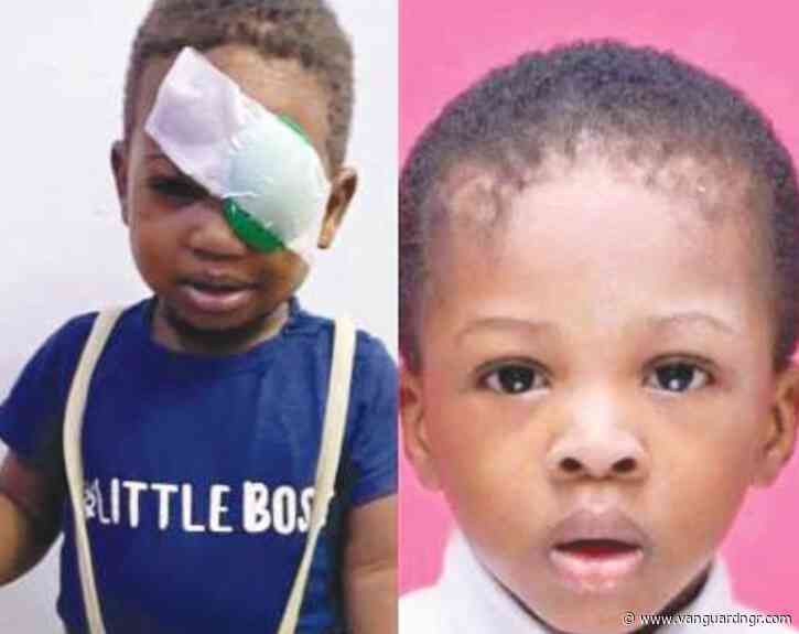 NDLEA shooting: Parents of slain toddler seek compensation as survivor brother, 4, loses eye