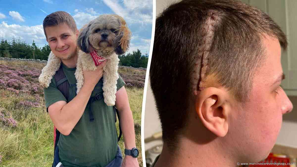 Man, 34, told 'there is nothing to worry about' diagnosed with incurable brain cancer