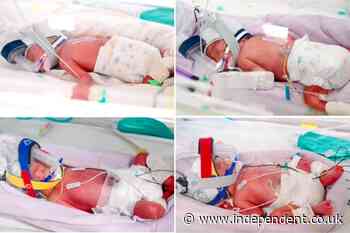 Woman defies the odds and gives birth to rare identical quadruplets in ‘one in 15 million’ pregnancy