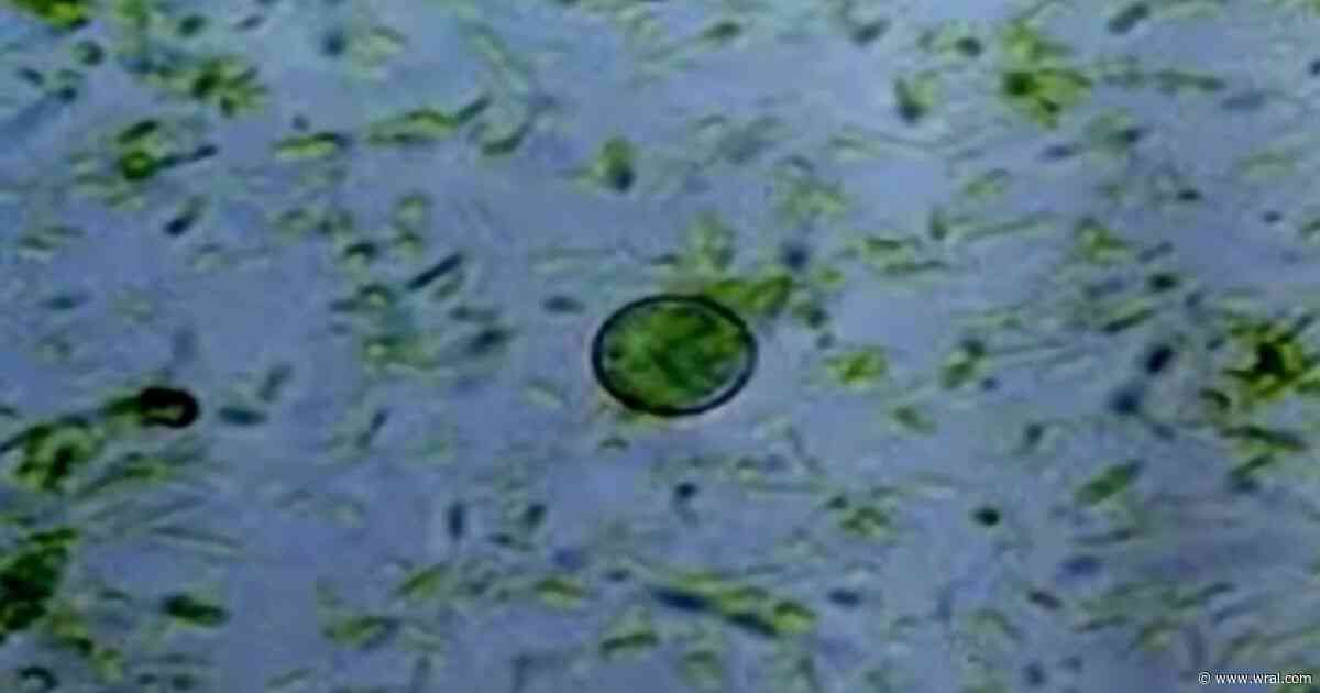 Cyclospora in NC: State reports 561 cyclosporiasis cases since May