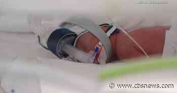 Australian woman gives birth to rare identical quadruplet daughters