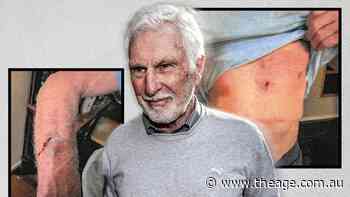 Photos reveal Mick Malthouse’s injuries after fighting off would-be intruders