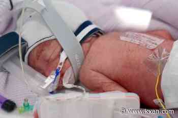 Woman gives birth to rare identical quadruplet girls in Australia