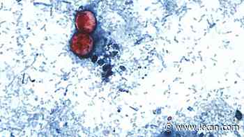 Cyclosporiasis vs. other food poisoning: How to spot the difference
