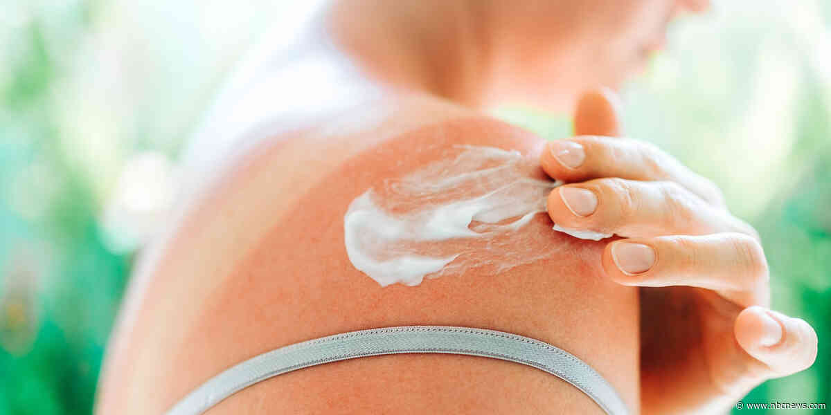 The best ways to avoid (and treat) heat rash and sun poisoning, according to derms