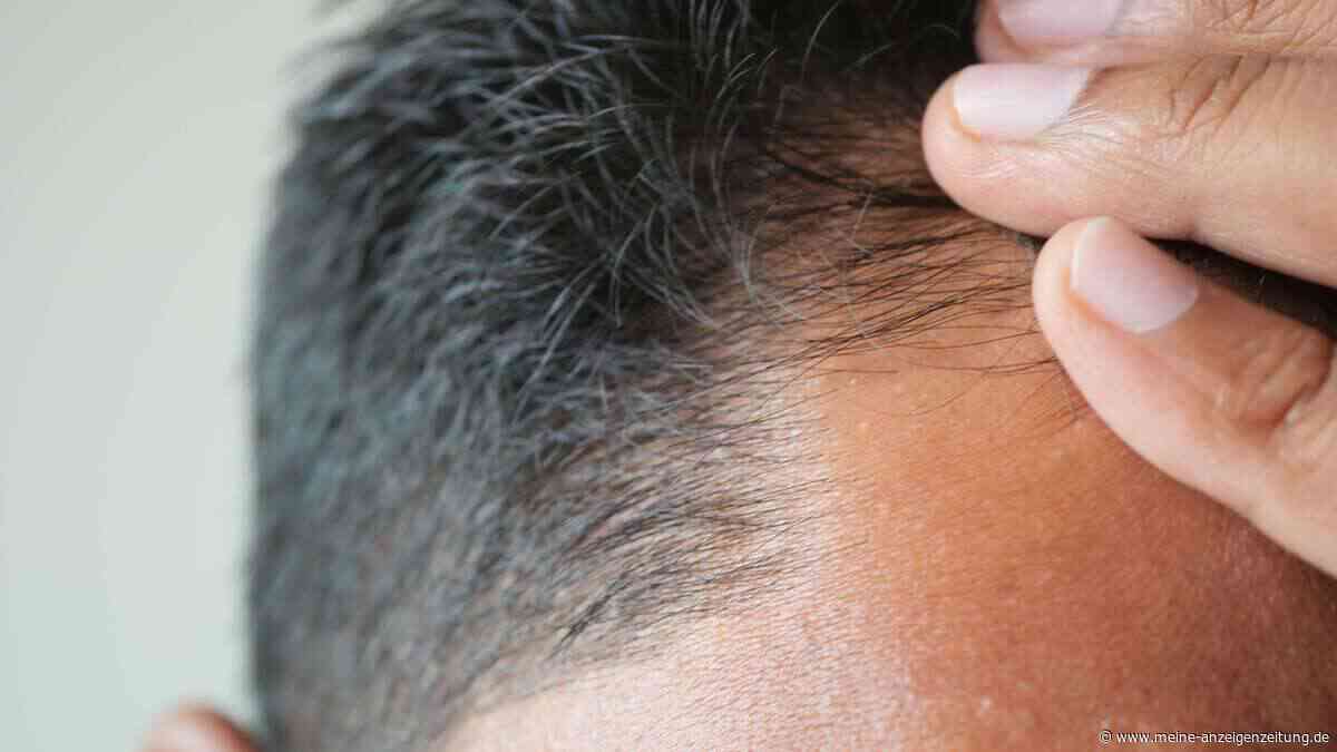 Haarausfall bei Ozempic & Co.: Wie hoch das Risiko laut Studien wirklich ist