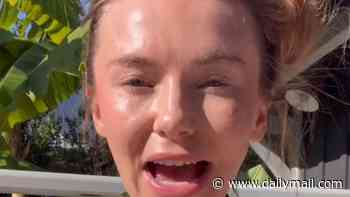 Bikini-clad Georgia Toffolo details her 15-year struggle with severe acne and admits she's baffled as to why it flares up at home