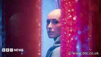 'I never dreamed I'd go on stage completely bald'