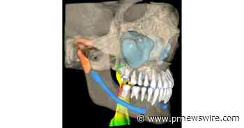 VELMENI Receives FDA 510(k) Clearance for AI-Powered 3D CBCT Dental Imaging Software