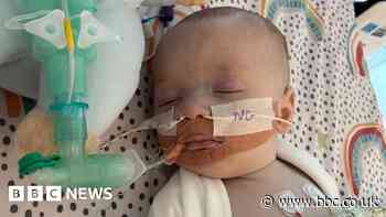 Baby can't access lifesaving treatment