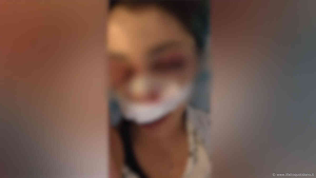 Bari, 26enne aggredita da dieci ragazzini. “I soccorsi li ho chiamati io”