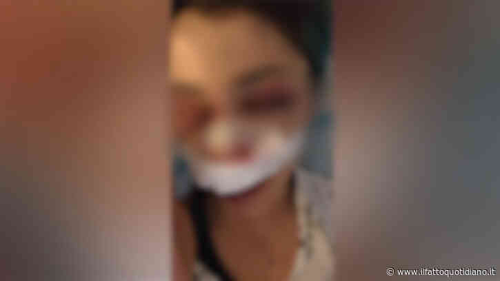 Bari, 26enne aggredita da dieci ragazzini. “I soccorsi li ho chiamati io”