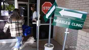 U.S. measles cases have already broken last year's record