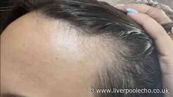 Hair loss sufferers notice 'remarkable difference' with £29 growth serum