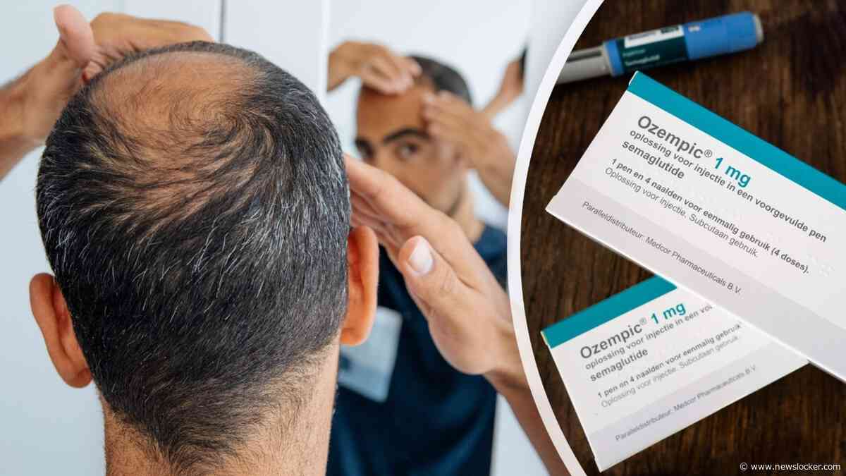 Afslankmedicatie in verband gebracht met mogelijk verhoogd risico op haaruitval, soms tot wel 68 procent meer kans