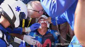 Horror moment Tour de France cyclist crashes face-first into car's rear windscreen - as bloodied rider is left needing 20 stitches before withdrawing from race