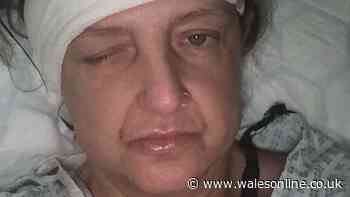 '111 Staff told my sister to take paracetamol - then she fell into a coma'