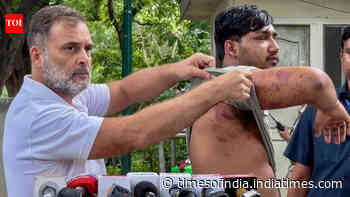 'Who approved pellet guns?' Rahul Gandhi writes Amit Shah over 'barbaric assault' on students