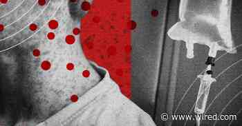 Measles Is Becoming So Common That Treatments May Soon Be Needed