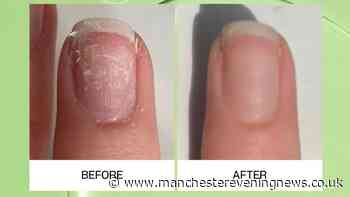 Woman 'tried everything' to repair nails but finds 'only one product that works'