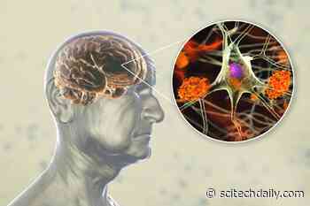 Plant Compounds in Berries, Tea, and Cocoa May Support Healthy Brain Aging