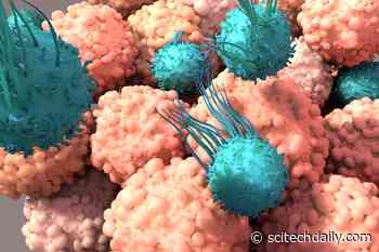 Scientists Find a Way To Keep Cancer-Fighting T Cells From Burning Out