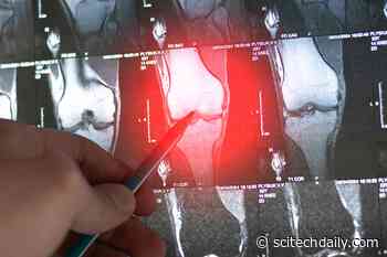 Scientists Test Natural Compounds Against Sarcoma: Which One Shows the Most Promise?